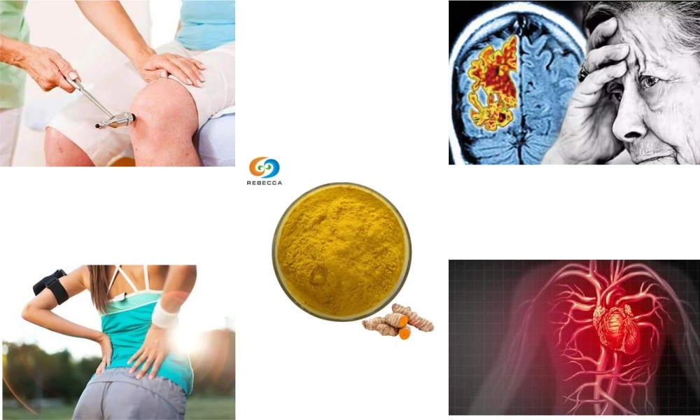 Best Curcumin Powder for Joint Health and Pain Relief